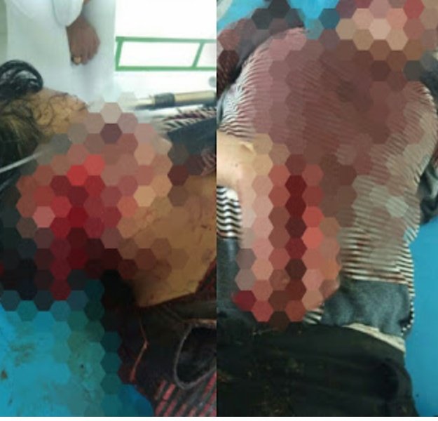 Seorang Bocah Dibacok Ayah Tirinya IMG_20181210_182244