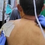 Usai Jemput Aspirasi Masyarakat, Anggota DPRD Madina Ditikam Warga di Pintu Padang Julu Siabu